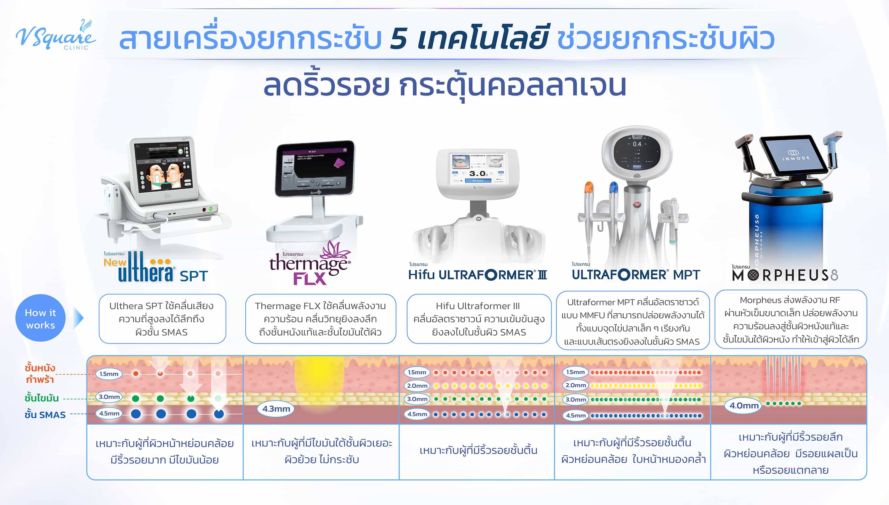 สายเครื่องยกกระชับ5 เท