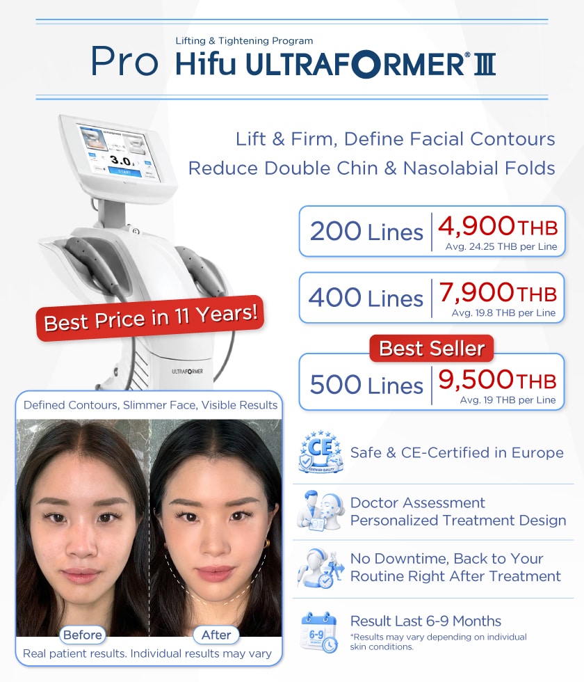 Promotion Hifu