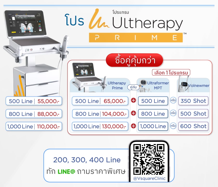 โปร_SPT-Prime_Volnewmer_09JAN25_TH