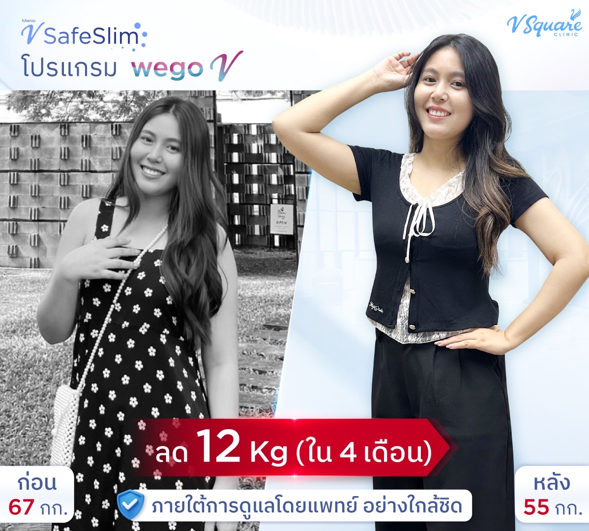 BA-VSafeSlim-ดิว