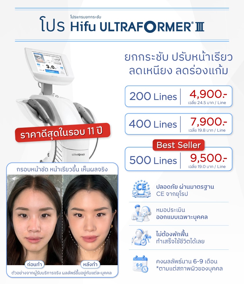 โปร HIFU