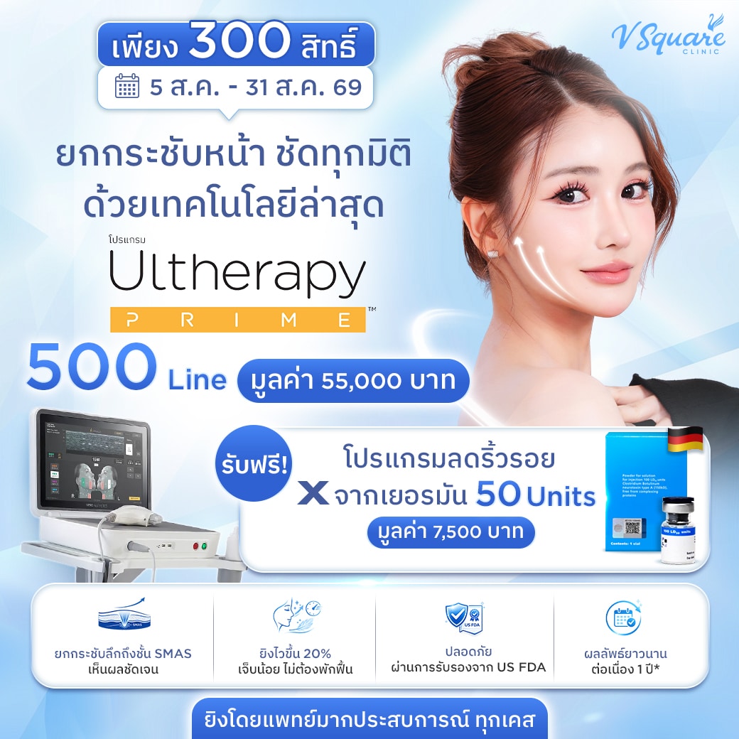 โปรโมชัน Merz Ultherapy Prime 500 Line แถม Xeomin