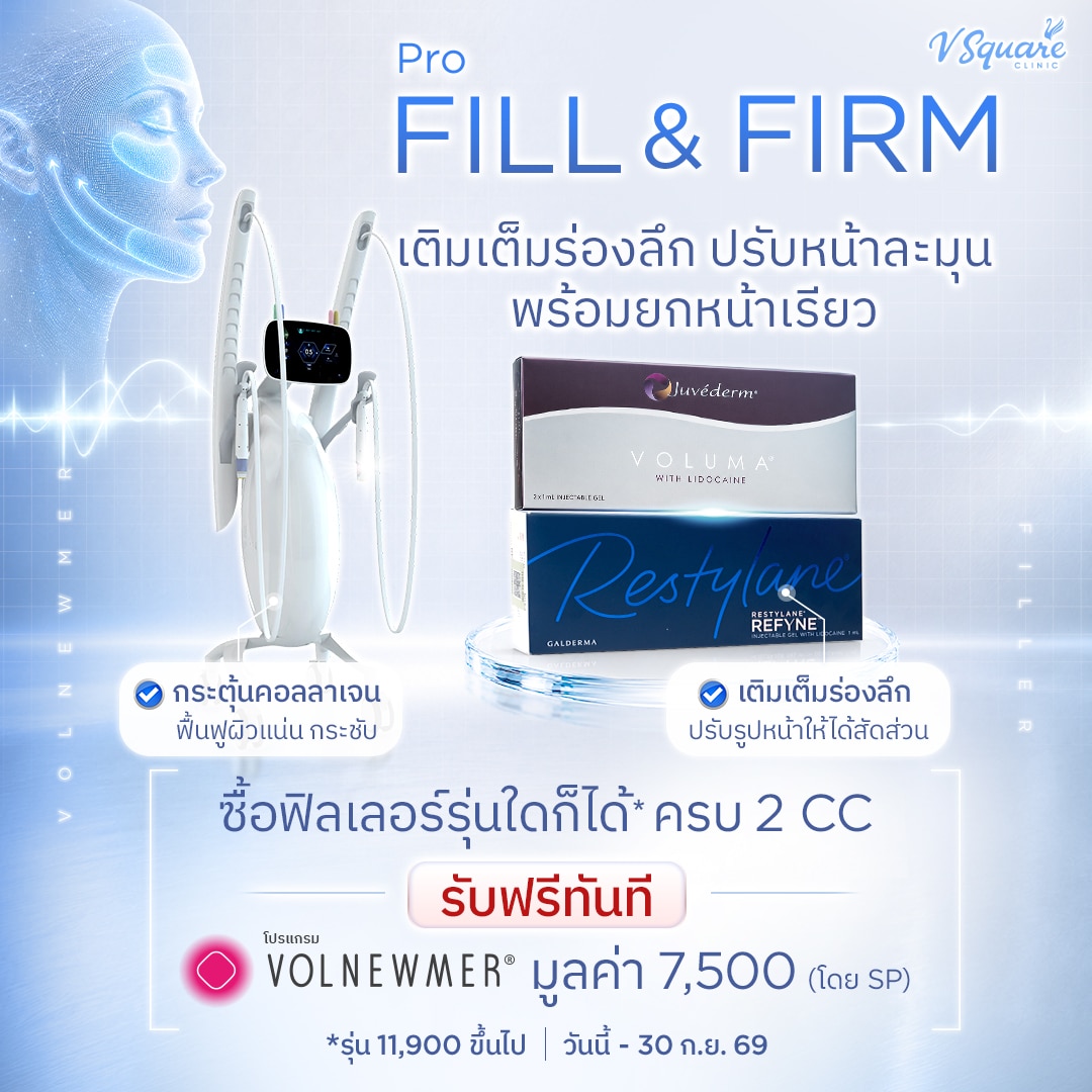 โปรฟิลเลอร์