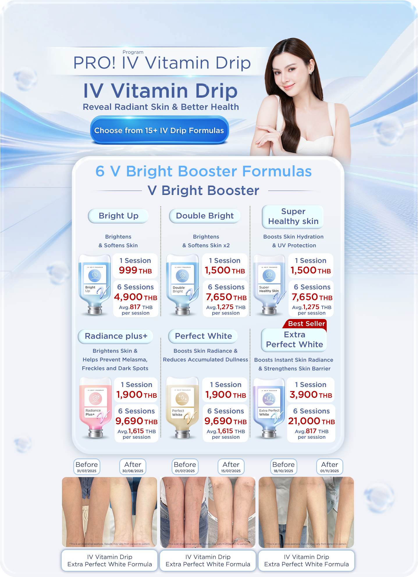 promotion-iv-drip