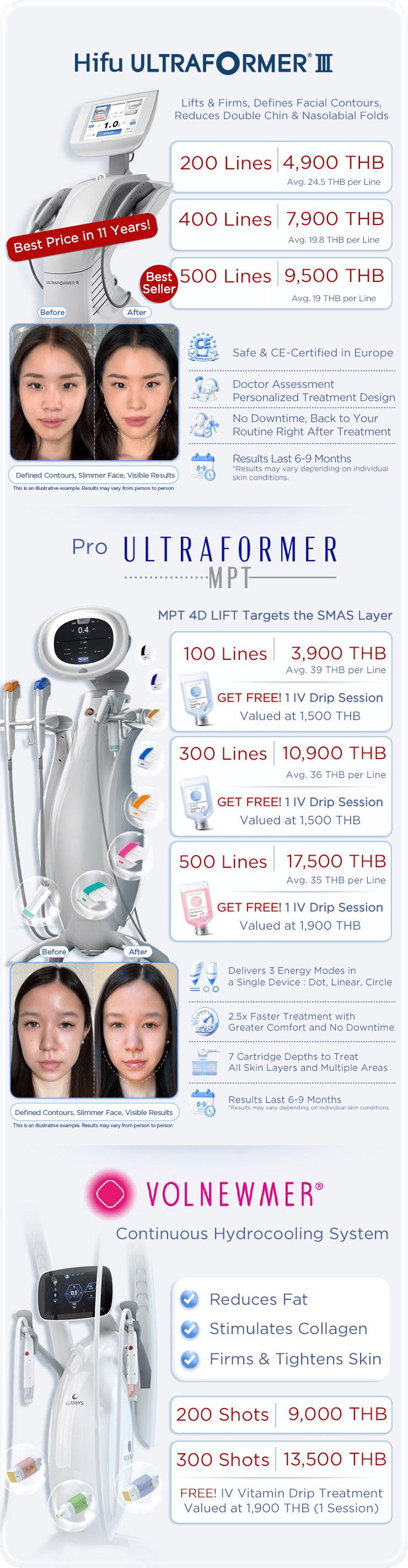 promotion-ultraformer