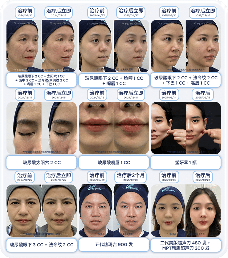 review-before-after