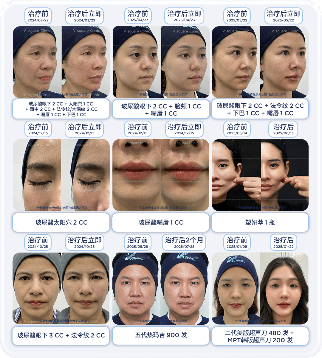 review-before-after