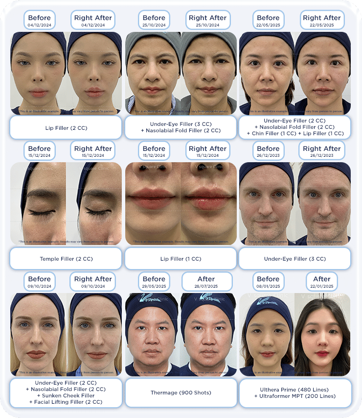 review-before-after