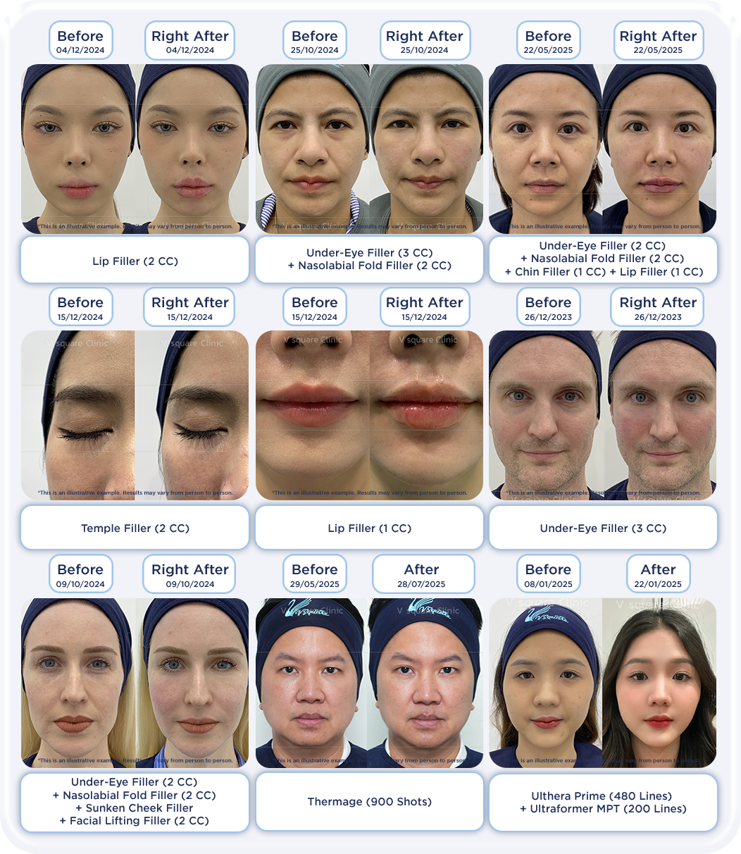 review-before-after