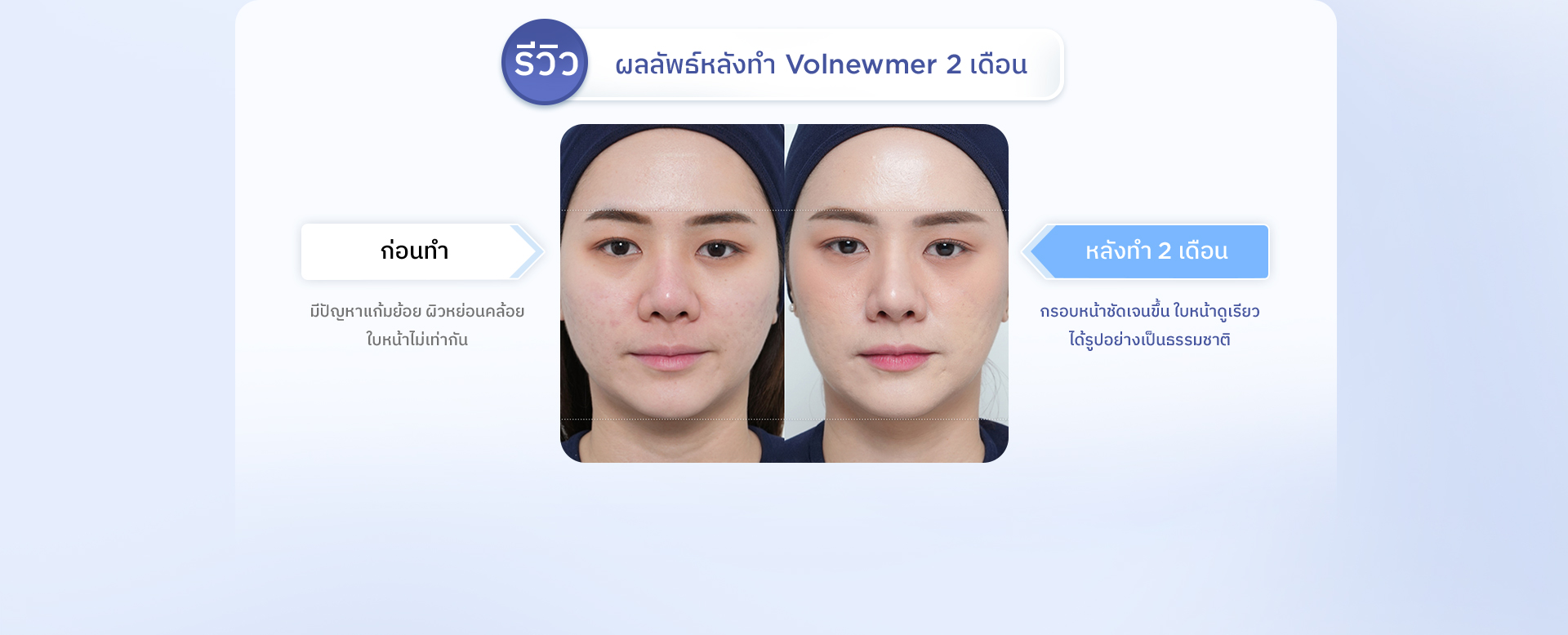 section-volnewmer-2